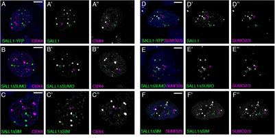 SALL1 Modulates CBX4 Stability, Nuclear Bodies, and Regulation of Target Genes